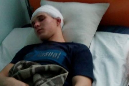 Школьники под Киевом зверски избили сына чиновницы и бросили умирать