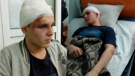Школьники под Киевом зверски избили сына чиновницы и бросили умирать