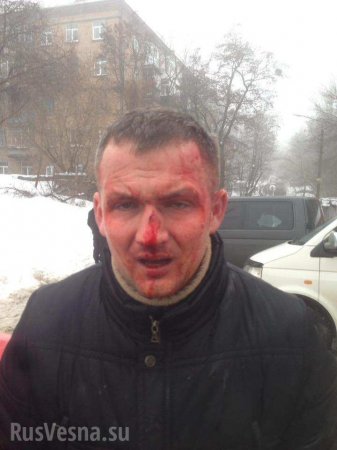 В Киеве сильно избили нардепа от «Свободы» (ФОТО, ВИДЕО)