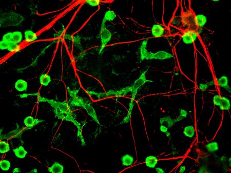 Созданы и опробованы антитела, обращающие вспять старение мозга
