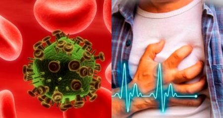 Люди с ВИЧ в группе риска: опасный вирус ведёт к болезням сердца — Медики