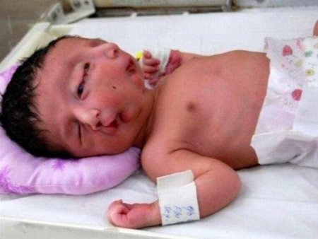 Инвалиды Нибиру: инопланетный вирус породил двуликого мальчика в Китае